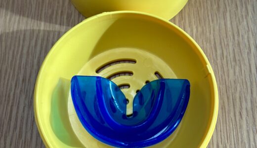 マウスピース矯正日記①　5歳娘の反対咬合はマウスピースで治るか